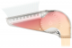 WING-W150-5